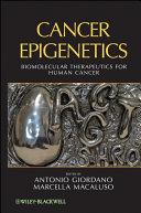 Cancer Epigenetics                                                                                                                                    <br><span class="capt-avtor"> By:                                                  </span><br><span class="capt-pari"> Eur:146,33 Мкд:8999</span>